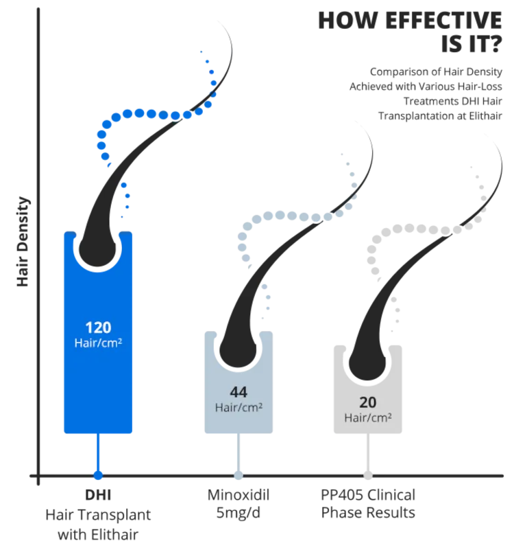 A graphic displaying the density results of DHI hair transplant from Elithair, Minodixil, and PP405 clinical phase.