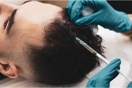 Medical professional injecting treatment into a man’s scalp, performing a PRP procedure.