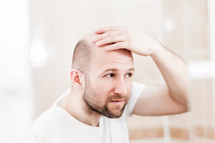 A balding man examines his hairline.