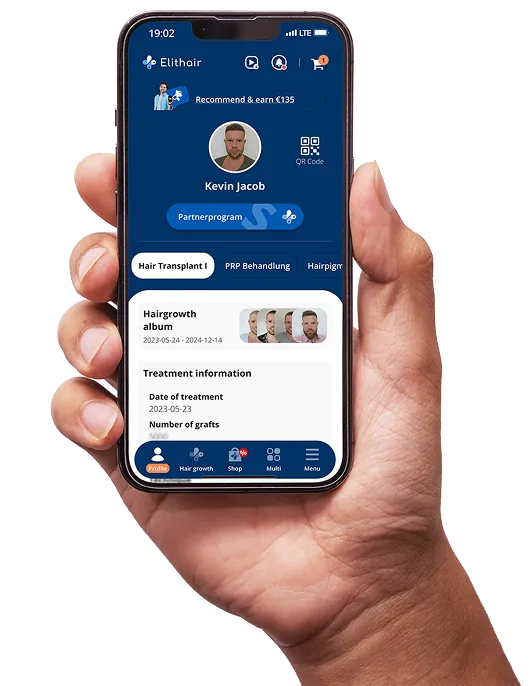 Hand holding a smartphone displaying the Elithair app profile screen with patient details, treatment dates, and hair growth progress photos.