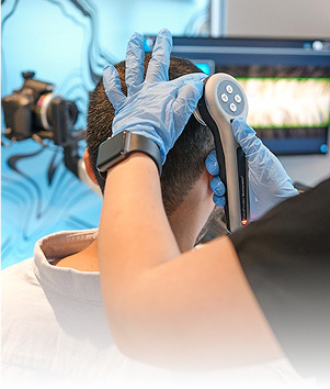 Elithair dermatologist wearing gloves performing Elithair's pre test system on a patient’s scalp with a digital hair analysis device.