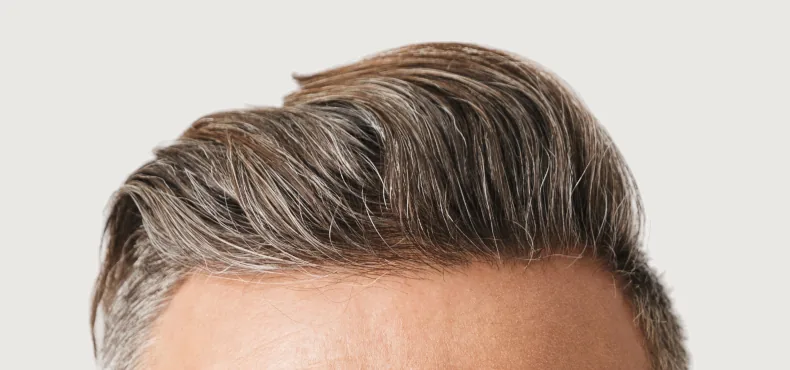 Close-up of a man’s neatly styled grey hair showing a healthy and full hairline against a plain background.