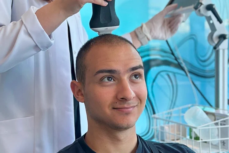 Man receiving a medical scalp examination – hair density analysis for early-stage hair loss