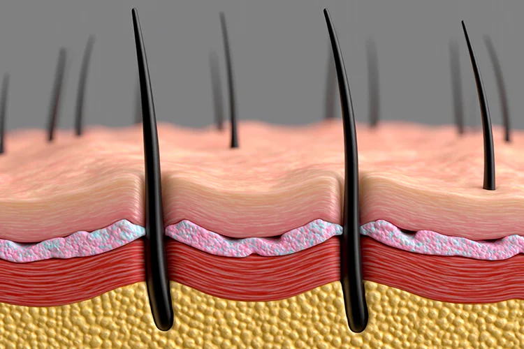 A cross section illustration of the layers of the skin, including hair and hair follicles.