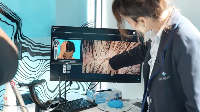 Pic shows Elithair specialist doing the Pre-Test System with a patient for the hair transplant in Turkey