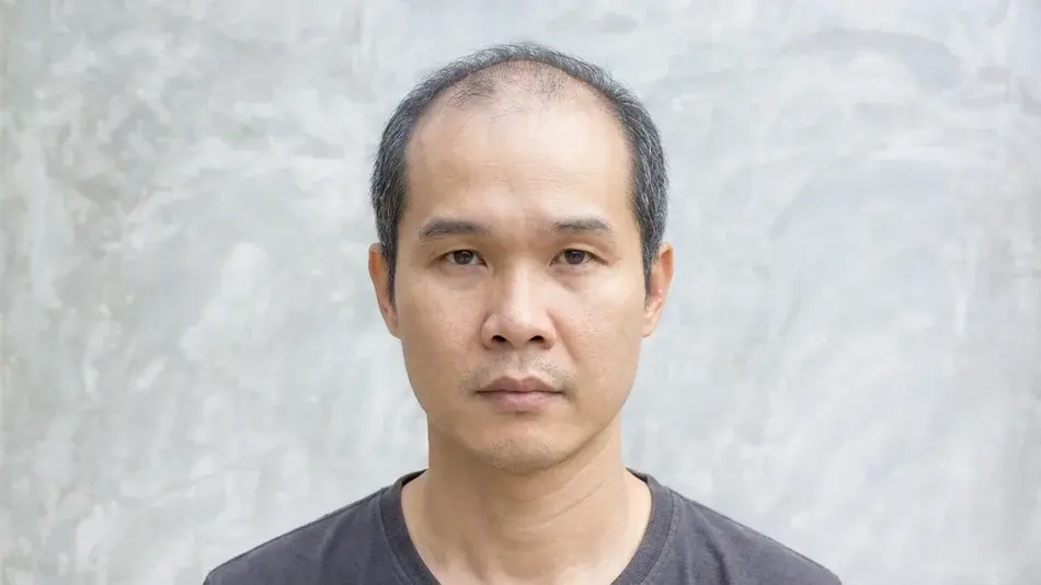 A balding South Korean man stares directly at the camera.